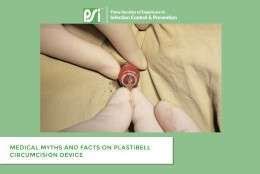 Medical Myths and Facts on Plastibell Circumcision Device